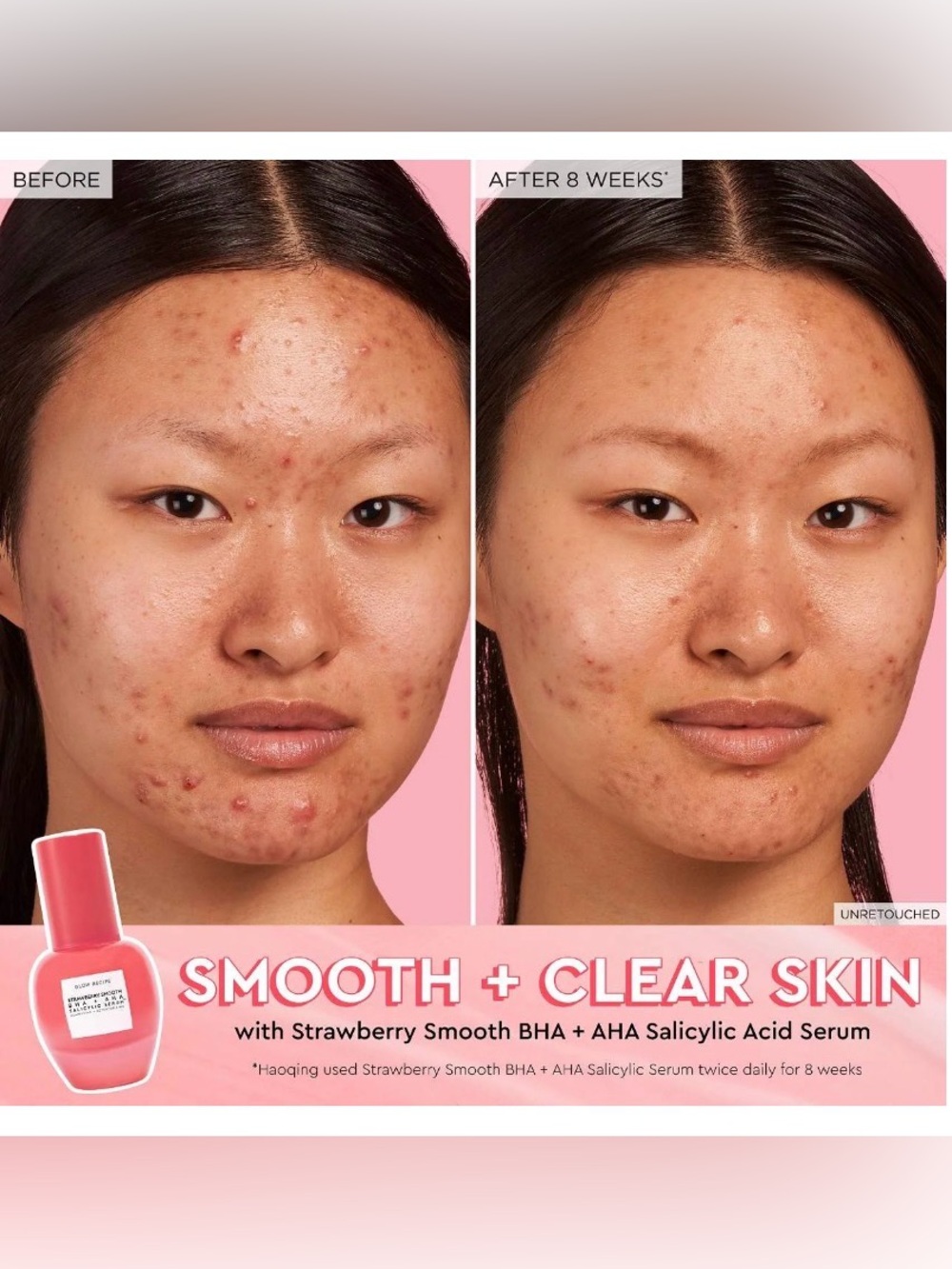 NIB Glow Recipe Fruit Babies Best Sellers Skincare Set - Picture 5 of 9